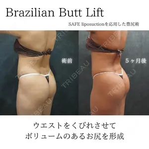 症例