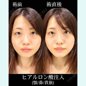 HAAB×DREAM BEAUTY CLINIC 東京本院 佐野 圭医師の症例