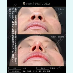 eクリニック 福岡院 伊藤 渉医師の症例
