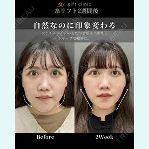 gift clinic 能登谷 翔医師の症例