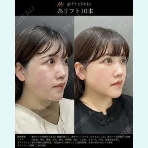 gift clinic 能登谷 翔医師の症例
