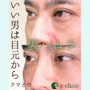 症例