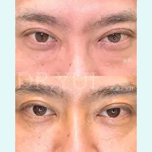 症例