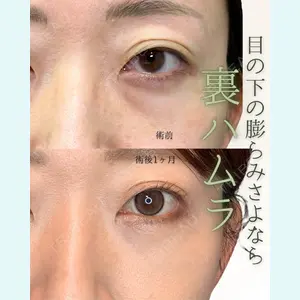 症例