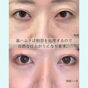 症例