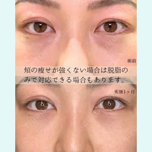 eクリニック 東京院 坂本 優衣医師の症例