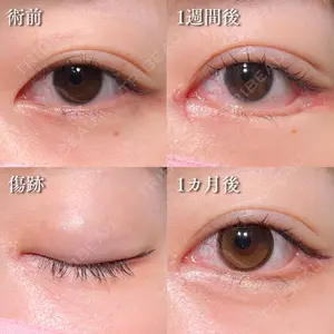 HAAB×DREAM BEAUTY CLINIC 大阪梅田院 鈴木 馨斗医師の症例