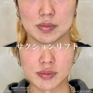 KAGA CLINIC 加賀 裕基医師の症例
