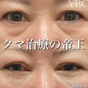 YBC横浜美容外科 大宮院 磯村 亮輔医師の症例