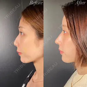 R Beauty CLINIC 大阪院の症例