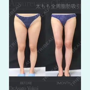 アムルーズ美容外科クリニック 横浜院 横井 麻人医師の症例