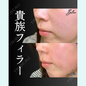 症例