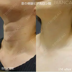BIANCA銀座 南 寿美医師の症例