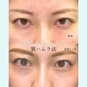 eクリニック 東京院 坂本 優衣医師の症例