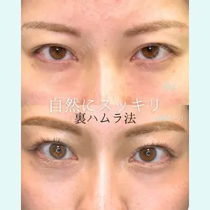 eクリニック 東京院 坂本 優衣医師の症例