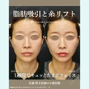 シンデレラ＆ダヴィンチクリニック 佐藤 博文医師の症例