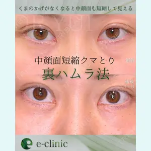 eクリニック 東京院 坂本 優衣医師の症例