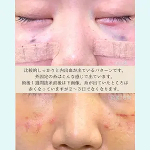 eクリニック 東京院 坂本 優衣医師の症例