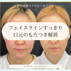 自由が丘ウェルエイジングビューティークリニックの症例