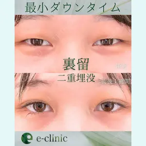 症例