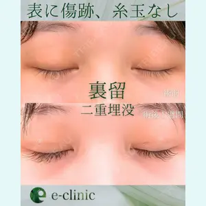 症例