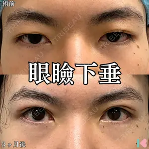 症例