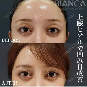 BIANCA銀座 南 寿美医師の症例