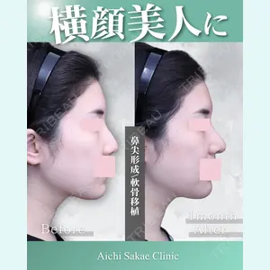 症例