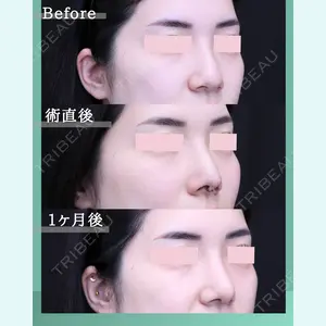 症例