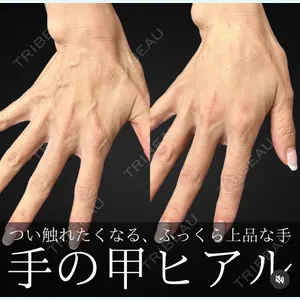 BIANCA銀座 明石 仙姫医師の症例
