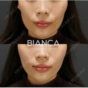 BIANCA銀座 服部 有美医師の症例