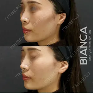 BIANCA銀座 服部 有美医師の症例