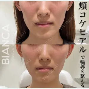 BIANCA銀座 服部 有美医師の症例