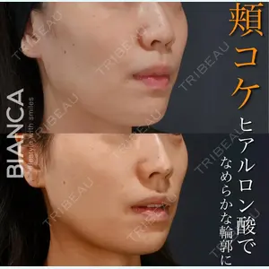 BIANCA銀座 服部 有美医師の症例