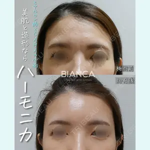 BIANCA表参道 大久保 由有医師の症例
