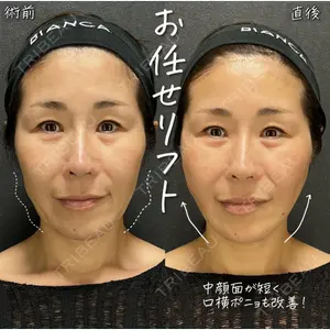 BIANCA表参道 大久保 由有医師の症例