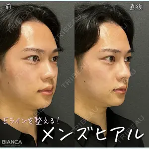 BIANCA表参道 大久保 由有医師の症例