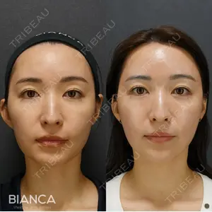BIANCA表参道 大久保 由有医師の症例