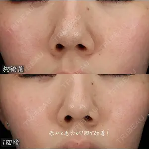 BIANCA表参道 大久保 由有医師の症例