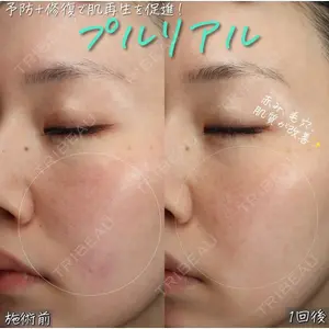BIANCA表参道 大久保 由有医師の症例