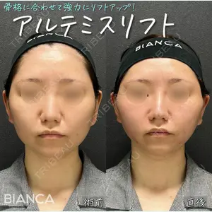 BIANCA表参道 大久保 由有医師の症例