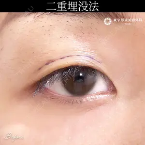症例
