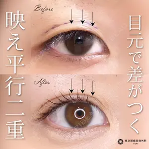 症例