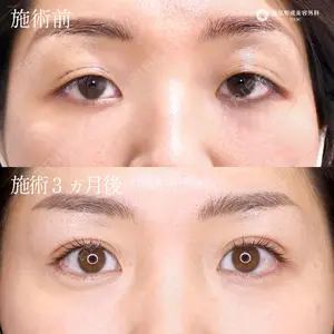 東京形成美容外科 船橋院 弓削田　浩主医師の症例