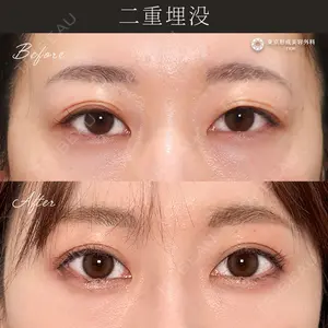 症例