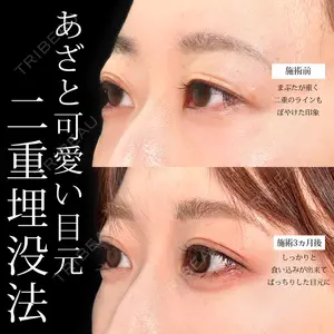 症例