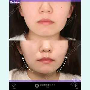 東京形成美容外科 銀座院 中尾 真紀医師の症例