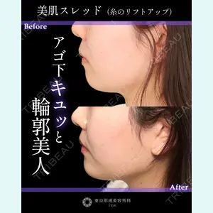 東京形成美容外科 銀座院 中尾 真紀医師の症例