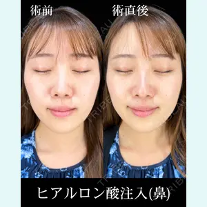 HAAB×DREAM BEAUTY CLINIC 東京本院 佐野 圭医師の症例