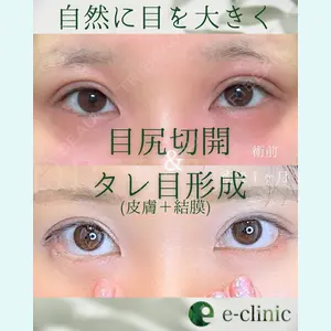 症例
